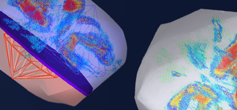 Tension Remove Process Detail
